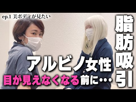 アルビノちゃん決意の太もも脂肪吸引！自分の美ボディを目が見えるうちに...！ep1｜美ボディラインch#203