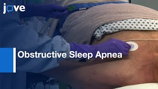 DISE with TCI and Bispectral Analysis in Obstructive Sleep Apnea | Protocol Preview