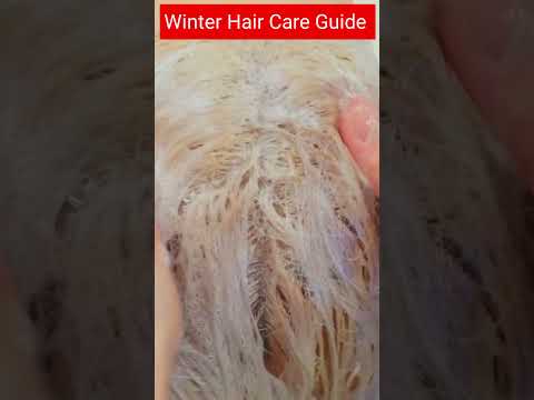 Winter Hair Care Guide | Winter Hair Essentials | Winter Hair Products | How To Vare Hair in winter