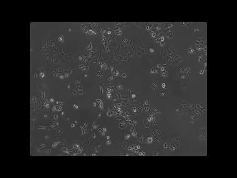 Myosin 6 in breast cancer cells – Video S7 [479151]