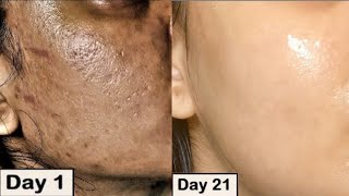 Damaged Skin Repair - DIY Damaged Skin Treatment At Home