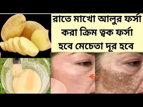 ত্বক হবে দাগহীন ফর্সা উজ্জ্বল গ্লোউইং রাতে লাগিয়ে নাও ঘরে তৈরী আলুর ক্রিম/Potato Facepack/Potato cre