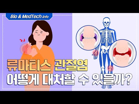 [셀트리온 C FILES] 류마티스 관절염 어떻게 대처할 수 있을까