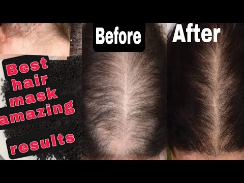 Amazing Hair Mask | One solution to all hair problems | Two ingredient hair mask