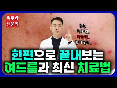 여드름의 예방법과 최신 치료법에 대한 모든 것! - 이것 1개만 보시면 됩니다!