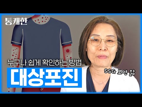 슥 보면 바로 압니다. 대상포진 피검사 하지 마세요.