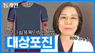 슥 보면 바로 압니다. 대상포진 피검사 하지 마세요.