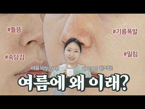 여름에 왜 이래? 기름폭발 여름 스킨케어, 개기름, 왕지성, 피부 뜨는데 덥기까지?!