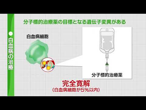 2022年1月15日放送　沢井製薬プレゼンツ　正しく理解しよう「血液がん」①白血病