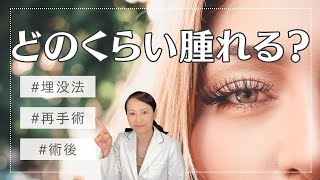 質問！埋没法の再手術どのくらい腫れる⁉︎