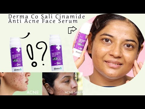 Derma Co Sali-Cinamide Anti-Acne Serum  Review | Fights Acne | Fades Acne Marks