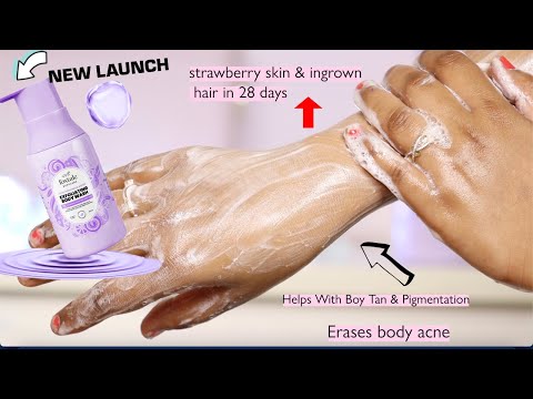 Foxtale Exfoliating Body Wash Review | Erases body acne, strawberry skin & ingrown hair in 28 days