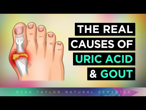 What REALLY Causes Gout & High Uric Acid?