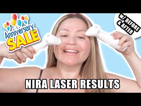 NIRA LASER RESULTS + NIRA ANNIVERSARY SALE 🥳 #niraskin