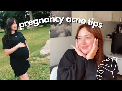 Acne During Pregnancy | Biochemist & Mom Perspective