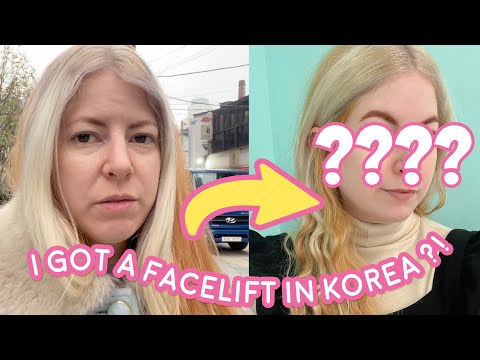 ☆My Experience with HIFU treatment at CNP Clinic Seoul South Korea ☆