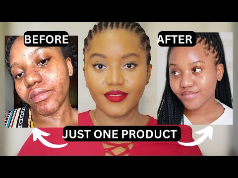 HOW TO GET RID OF DARK SPOTS WITH ONE PRODUCT | SERUM THAT WORKS