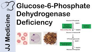 Glucose-6-Phosphate Dehydrogenase Deficiency | Symptoms, Pathophysiology, Diagnosis and Treatment