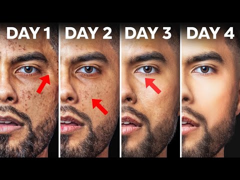 How to Glow Your Skin in Just 15 Days 🔥 | The Complete Scientific Guide