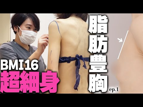 他院で「取れる脂肪がない」と言われ...授乳で削げた2児のママの胸を救う ep1｜美ボディラインch#221