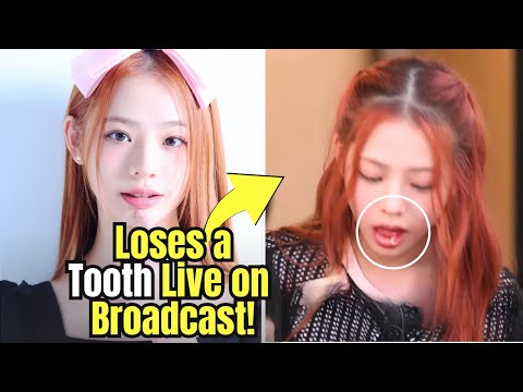 13 Year Old KPop Idol UNIS's Seowon Loses a Baby Tooth Live on Broadcast!