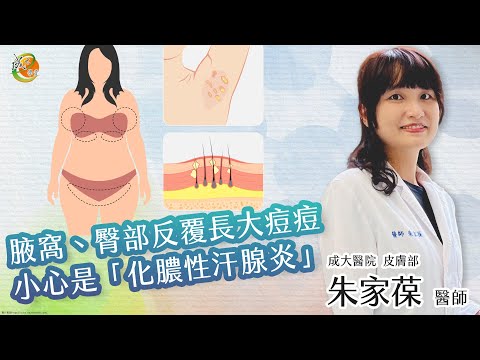 【化膿性汗腺炎】朱家葆醫師-成大e學堂