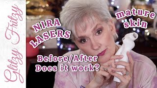 NIRA Lasers...Lies? 90 days 61 Year Mature Skin #notsponsored