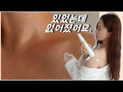 가드름 등드름 아토피 민감 피부에게 추천하는 바디로션 / 인그로운헤어 모공각화증 필수템