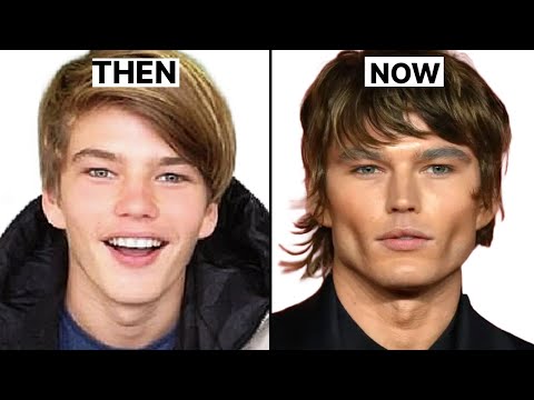 4 Most Common Plastic Surgeries Male Models Get (From a Model)