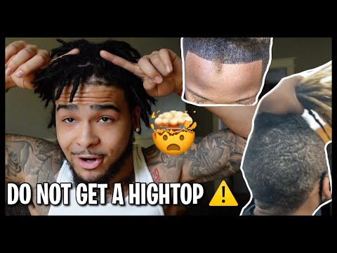 WATCH THIS BEFORE GETTING HIGHTOP LOCS ‼️ ARE HIGHTOPS LOCS BETTER THAN A FULL HEAD ⁉️