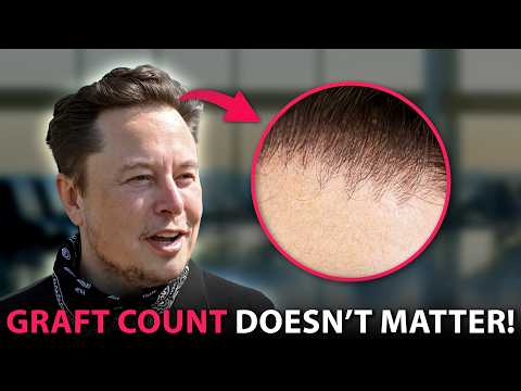 The #1 BEST Tip For A Hair Transplant