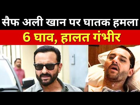 Saif Ali Khan Health Updates LIVE: सैफ अली खान पर चाकू से घातक हमला, हालत बेहद गंभीर | Lilavati