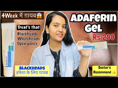 Adaferin 0.1% Adapalene Gel Review In Hindi | Best Gel For Removing Blackheads and Whiteheads