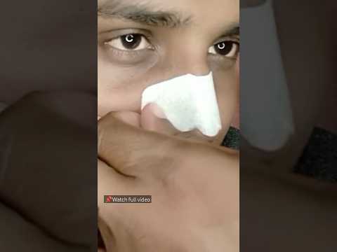 🔴Best Nose strip #shorts #youtubeshorts #shortvideo #ytshorts #trending #viral #short