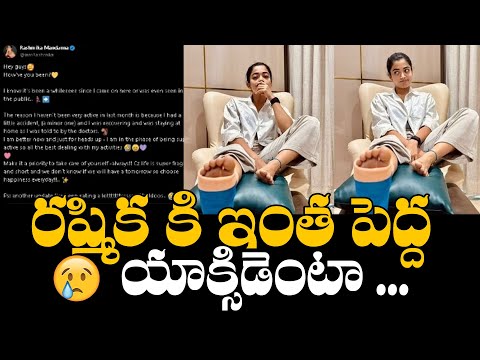 Rashmika Mandanna Suffers With Minor Accident | Rashmika Mandanna Injury | Daily Culture