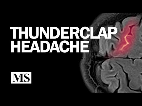 Thunderclap Headache