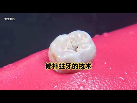 修补发霉蛀牙的全过程演示，超级解压，赶快来看