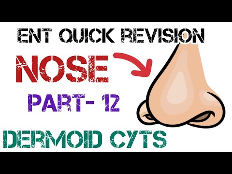 Dermoid Cysts: What You Need to Know | Causes, Treatments, and More by Dr. Deen