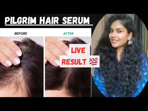 Best Hair Serum for Hair Growth | Hair fall | Pilgrim Hair Care Live Result#Hairserum#liveresultbest