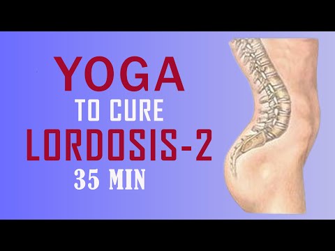 How to fix lordosis with yoga?, Best Exercises for Lumbar Lordosis, Which asana is used in lordosis?