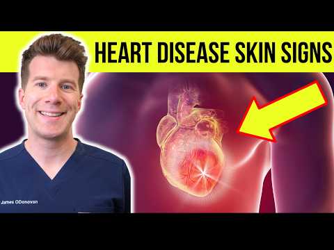 12 SKIN and NAIL signs of HEART DISEASE