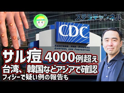 【サル痘】ニュース、ヨーロッパやアメリカなどの確定例が4000例を超える、台湾や韓国でも確認【CDC、イギリスglobal health、NEWS、天然痘、歴史、健康、猿とうウイルス】