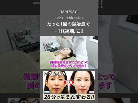 【40代のお悩み】たった1回の鍼治療で20年前の肌に若返る！たるみ肌が劇的改善！