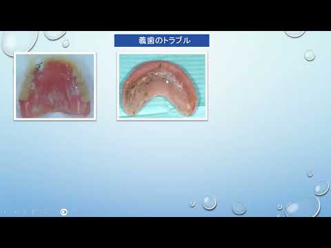 第76回「食」を支える会　「お口の評価について～はじめよう口腔連携強化加算～」