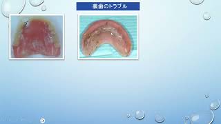 第76回「食」を支える会　「お口の評価について～はじめよう口腔連携強化加算～」