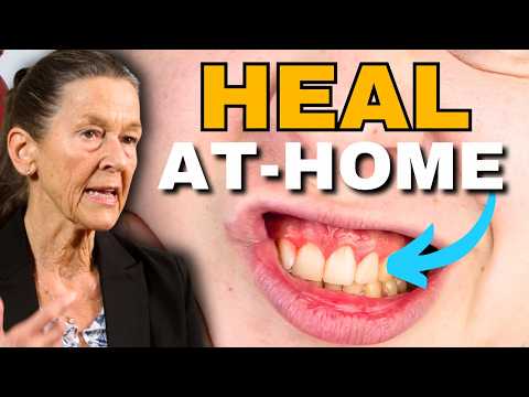 Quickly Heal Gingivitis & Bleeding Gums Naturally at Home