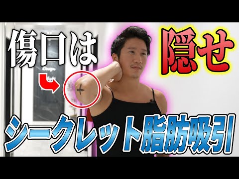 野中先生シークレット脂肪吸引解説