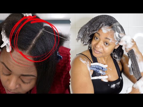 Get Rid Of SCALP BUILDUP | Seborrheic Dermatitis + Dandruff Wash Day Routine