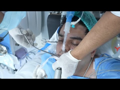 Man Goes Under Anesthesia Process Before Surgery