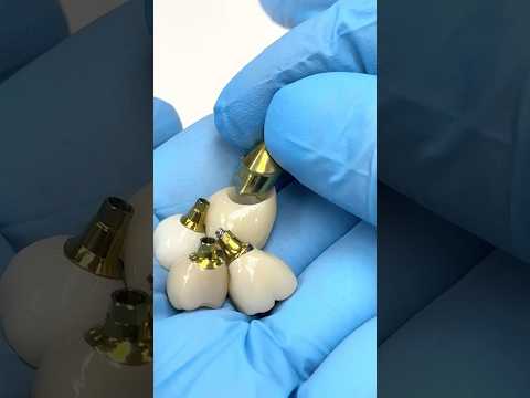 Gold-Anodized Abutments for Mini Syton Implants #lsk121shorts #dentist #teeth